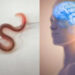 Extraen lombriz intestinal VIVA de 8 centímetros del cerebro de mujer australiana