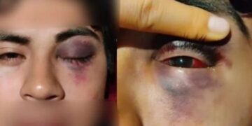 Denuncian brutal golpiza contra jóvenes en el bar “Una y ya” por no pagar propina