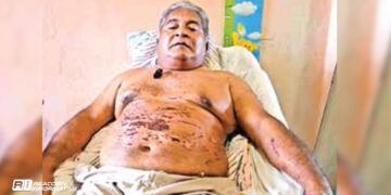 Sobrevivió a ‘Otis’, pese a hundirse a bordo de su barco; se le reventaron venas oculares