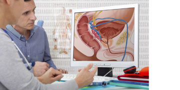 Uno de Cada 6 Hombres Será Diagnosticado con Cáncer de Próstata: Expertos