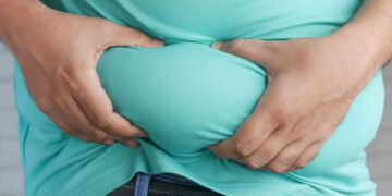 Una de cada ocho personas en el mundo sufre obesidad, la forma más común de malnutrición