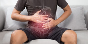 Alcanza a jóvenes el cáncer de colon