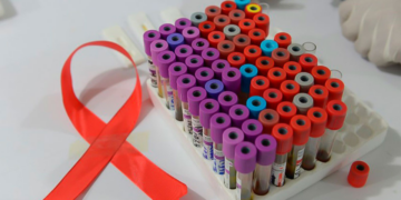 Un séptimo caso de cura probable del VIH tras un trasplante de médula ósea