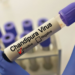 ¿Qué es el virus Chandipura, considerado el más grave de las últimas décadas?
