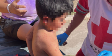 Muere niño de 6 años luego de ser picado por más de 100 abejas en Los Mochis
