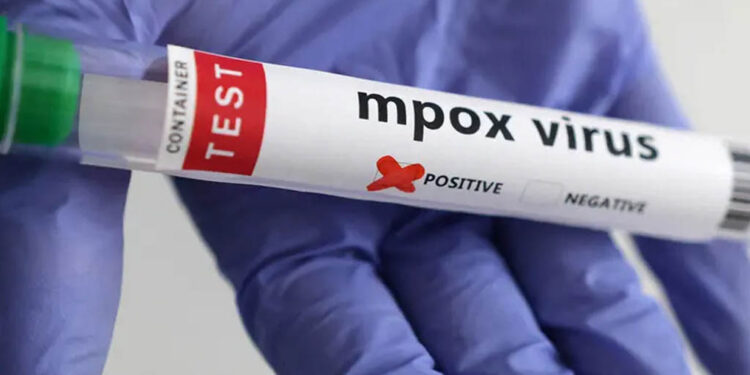 Viruela del mono: OMS necesita 87 millones de dólares para contener el brote de mpox