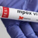 Viruela del mono: OMS necesita 87 millones de dólares para contener el brote de mpox