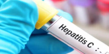 Cofepris aprueba medicamento huérfano para hepatitis C crónica en infantes