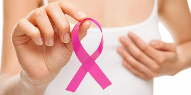Cáncer de Mama: costos ocultos y recursos financieros para sobrevivientes, de acuerdo a la Condusef