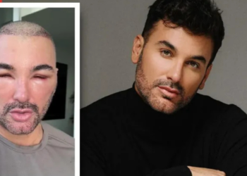 Rostro de Mauricio Mejía, querido actor mexicano, causa terror en redes por radical cambio; ¿Qué le pasó?