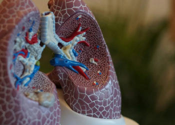 OMS alerta sobre medicamento falsificado para tratar el cáncer de pulmón no microcítico