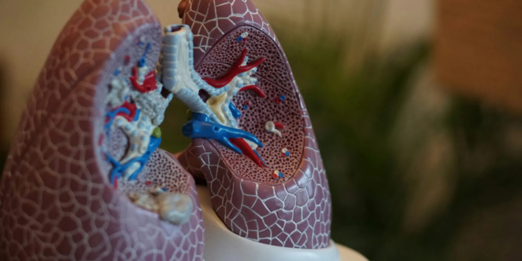 OMS alerta sobre medicamento falsificado para tratar el cáncer de pulmón no microcítico