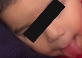 “Superbebé” con marcapasos necesita apoyo para su cirugía de pulmón; le quedan tan solo 8 meses de vida