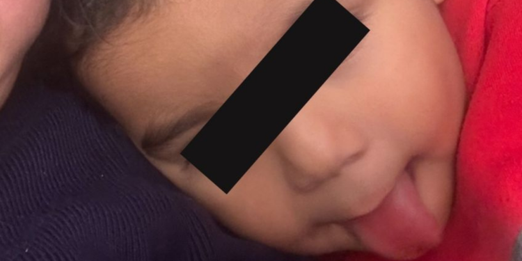 “Superbebé” con marcapasos necesita apoyo para su cirugía de pulmón; le quedan tan solo 8 meses de vida