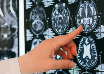 Científicos descubren una proteína capaz de detener el envejecimiento cerebral