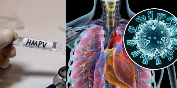 Metapneumovirus humano y COVID-19, ¿Cuál es la diferencia?