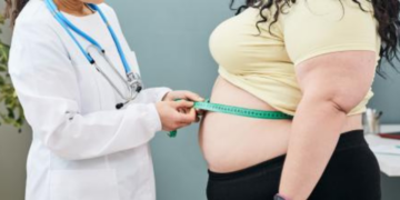 Piden especialistas en México redefinir la obesidad como enfermedad