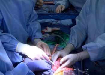 Un hígado de cerdo modificado genéticamente podría funcionar trasplantado en una persona