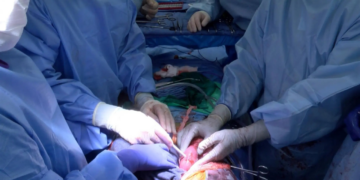 Un hígado de cerdo modificado genéticamente podría funcionar trasplantado en una persona