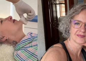 Mamá de Gala Montes sorprende con su nuevo rostro tras tratamiento estético