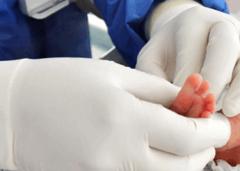 Mueren 45 bebés por tosferina; ninguno estaba vacunado