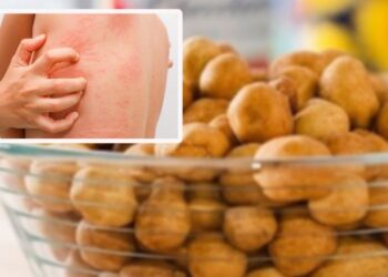 Retiran esta famosa marca de CACAHUATES de todas las tiendas, alertan por reacciones alérgicas como urticaria