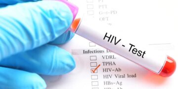 Incrementan los casos de VIH hasta en un 15% en Mazatlán