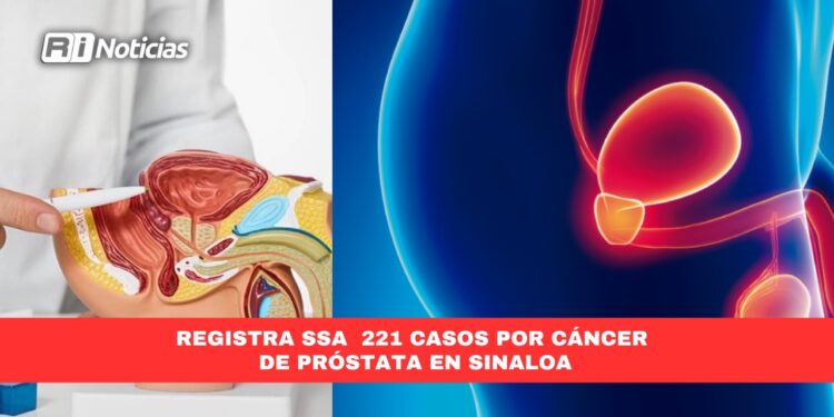 Registra SSA 221 casos por cáncer de próstata en Sinaloa