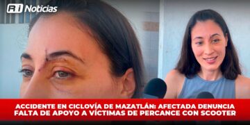 Accidente en ciclovía de Mazatlán: Afectada denuncia falta de apoyo a víctimas de percance con scooter