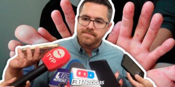 Detectan  más de 40 casos de “manos, pies y boca” en primarias de Sinaloa